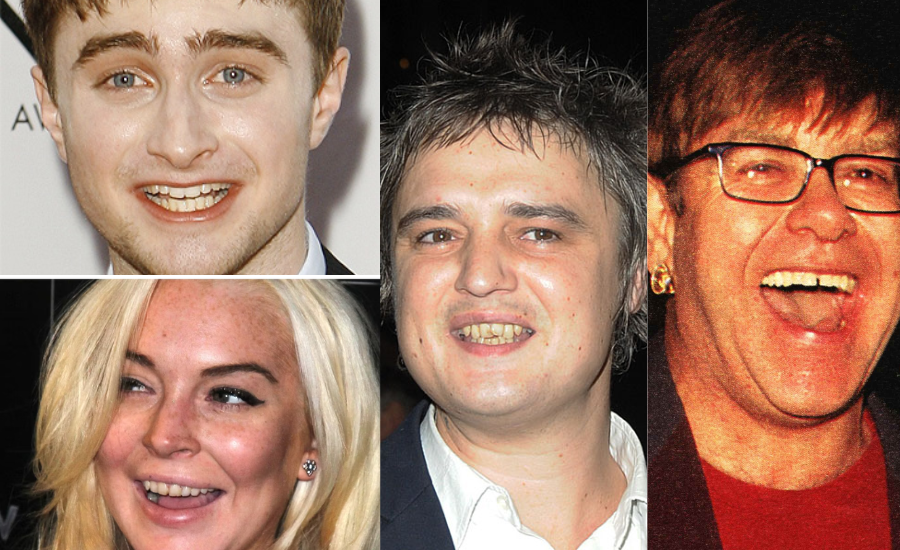celebrities with yellow teeth